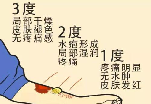 乒乓球技巧让生胶失去威力（以速度和控制击败生胶的秘诀）